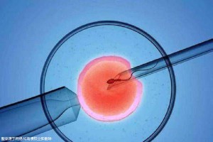 生殖内分泌专家
